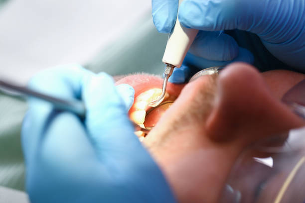 Best Broken or Cracked Tooth Emergency Dentist in Cherry Brah, NC