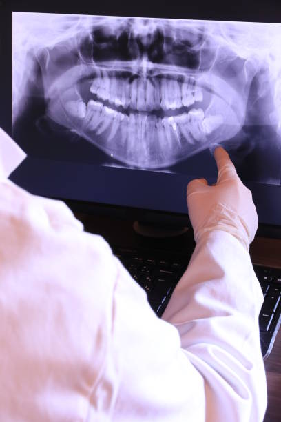 Best Holiday Emergency Dentist in Cherry Brah, NC