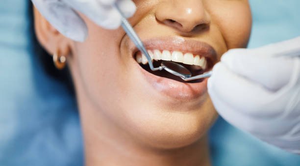Best Emergency Dental Care for Abscessed Tooth in Cherry Brah, NC