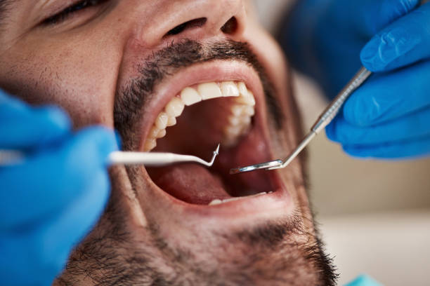 Best Emergency Dental Services for Seniors in Cherry Brah, NC
