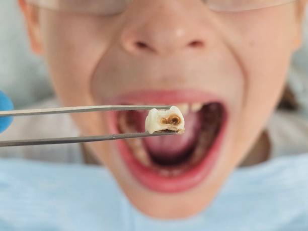 Best Mobile Emergency Dentist in Cherry Brah, NC