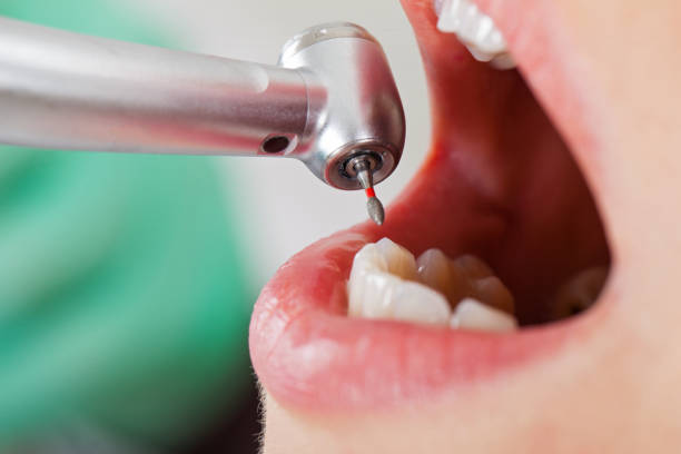 Best Weekend Emergency Dentist in Cherry Brah, NC